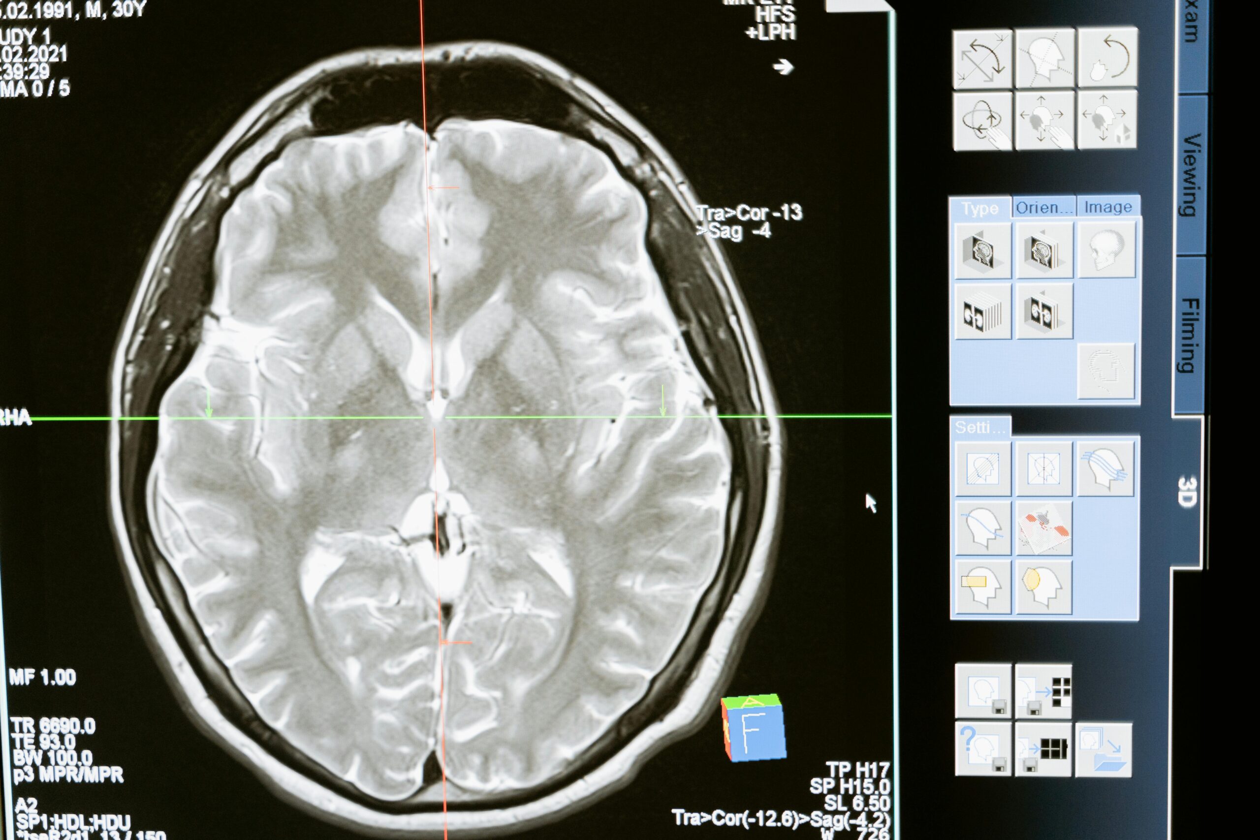 ai diagnostcs